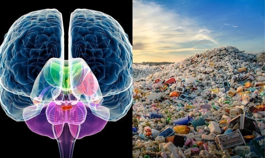 Estudio revela que microplásticos son capaces de llegar al cerebro 